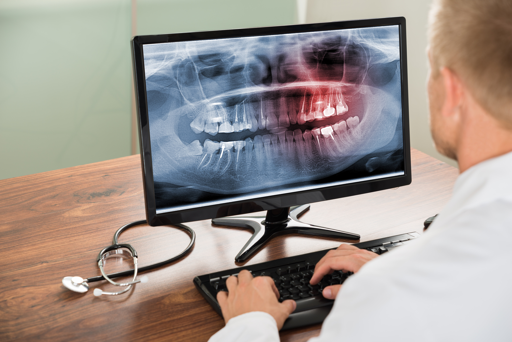 Close-up Of Male Doctor Looking At Teeth X-ray On Computer In Hospital